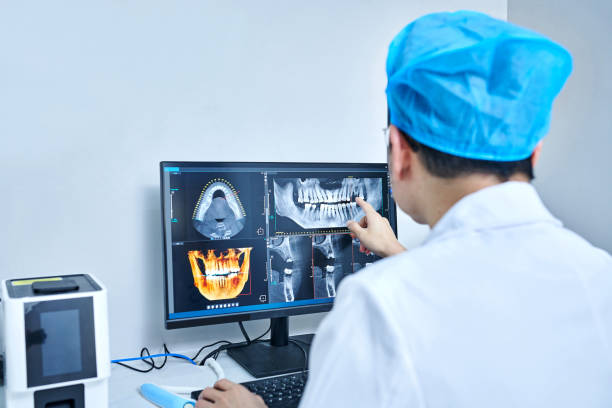 Best Emergency Dentist for Lost Fillings or Crowns in Stayton, OR